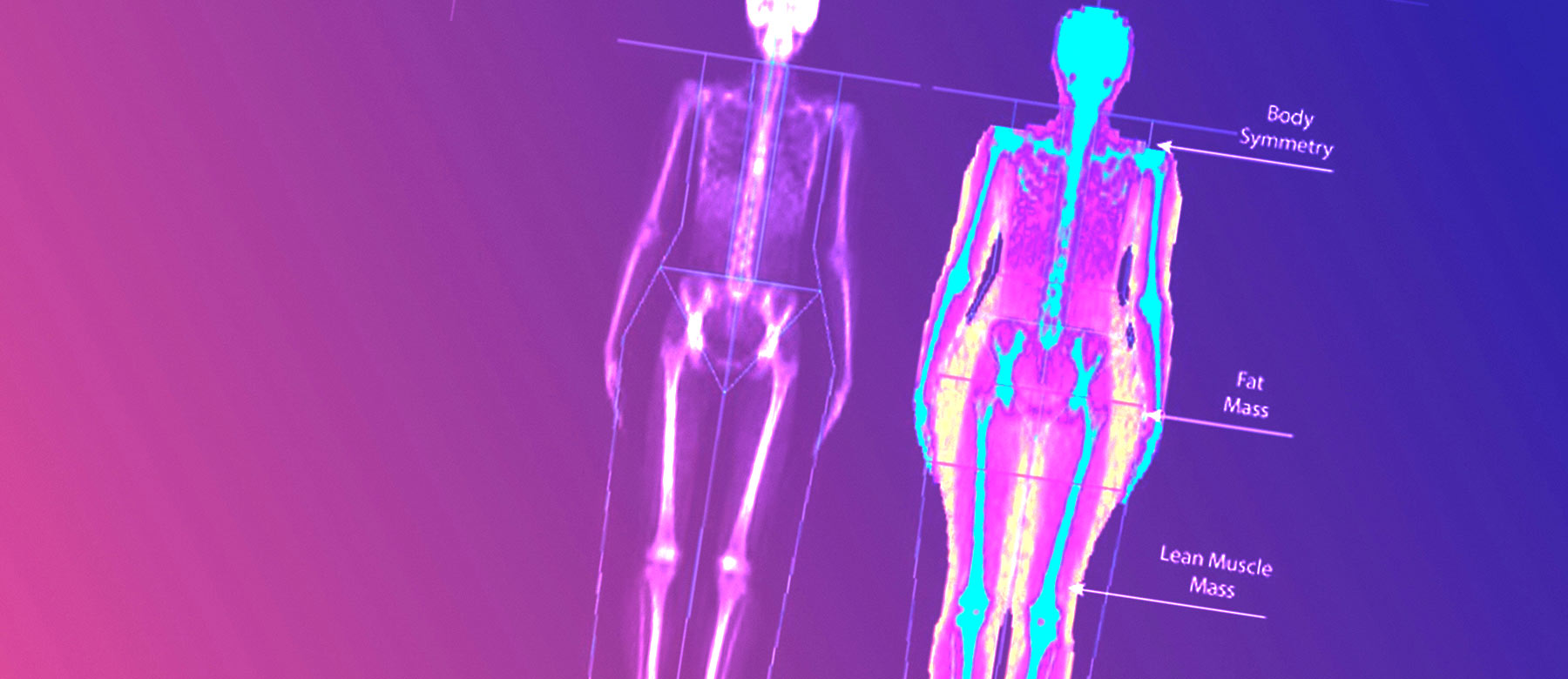 Horizon DXA Scan - Next Level Health